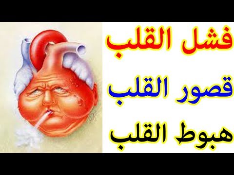 ما هو قصور القلب - معلومات عن قصور القلب 3648 1