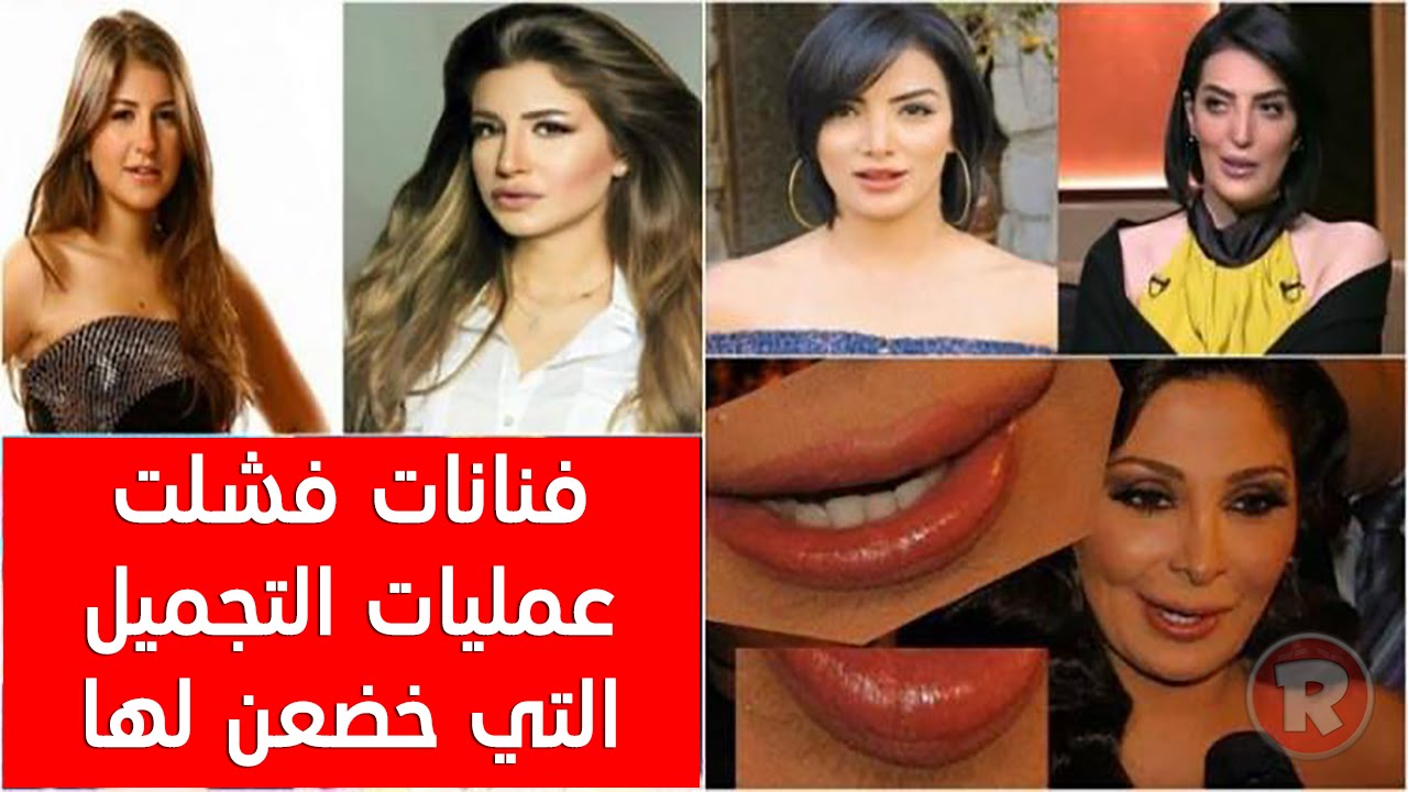 جميلات لبنان قبل وبعد عمليات التجميل - هتنصدم من عمليات التحميل في جميلات لبنان 1887 10