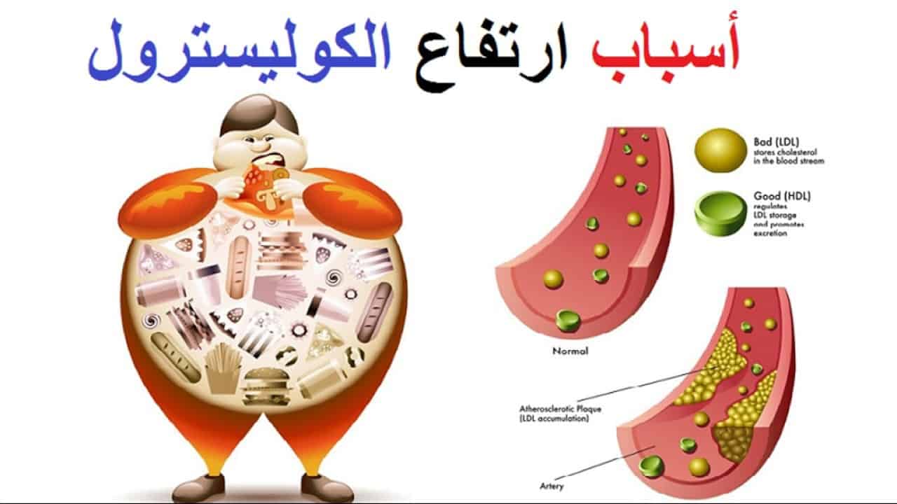 اعراض ارتفاع الكولسترول في الدم - خطر يصيب الجسم فتعرف عليه 897 3