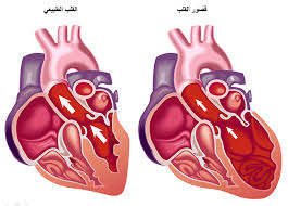 ما هو قصور القلب - معلومات عن قصور القلب Unnamed File 858