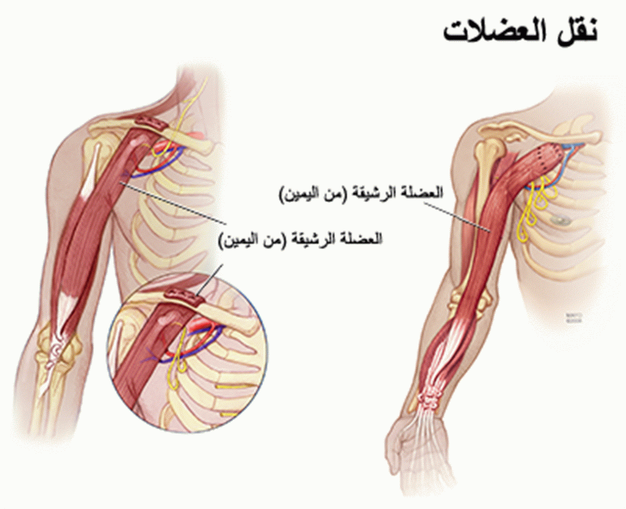 علاج قطع الحبل الشوكي في المانيا - اسهل طريقه لعلاج الحبل الشوكي 1883