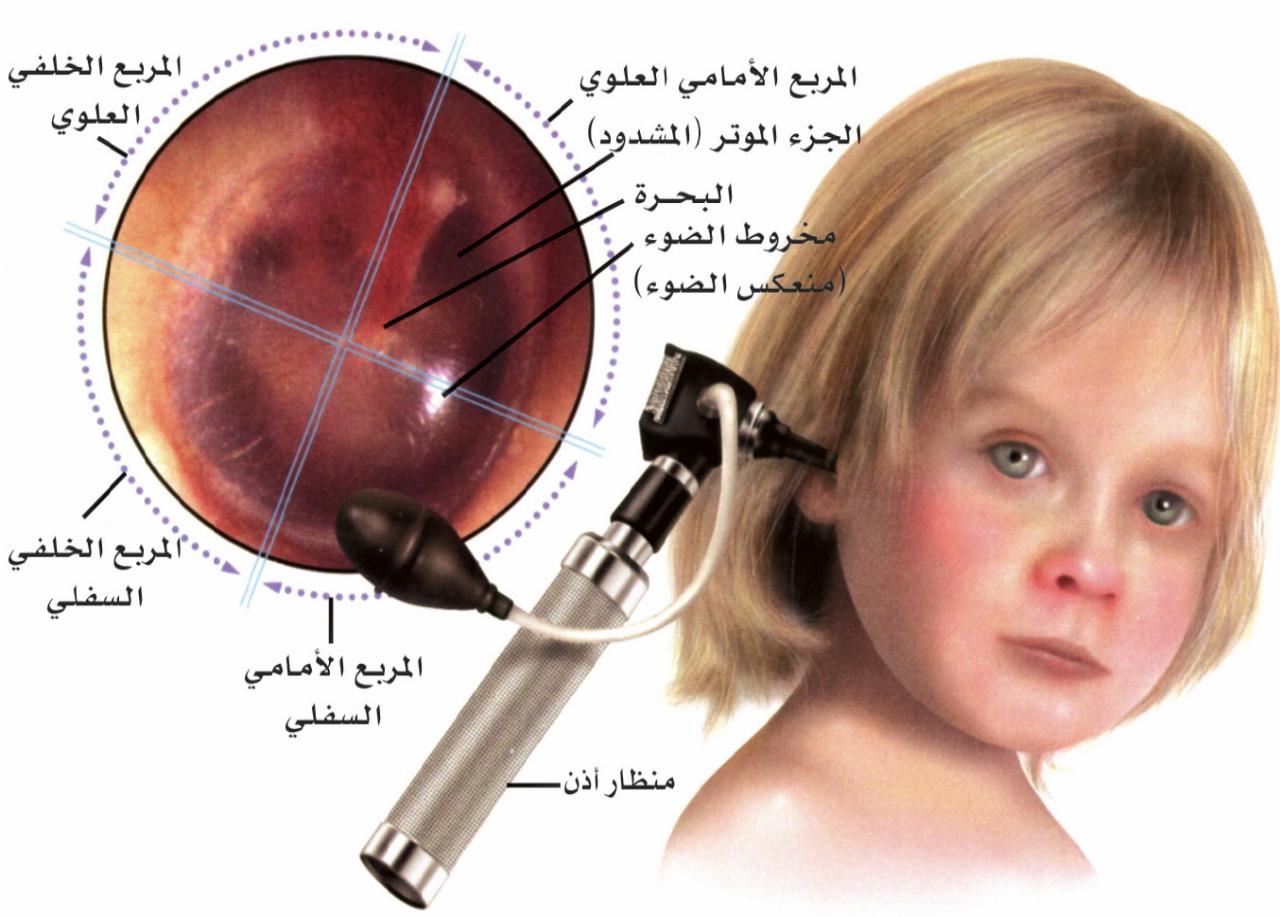 انتفاخ الاذن عند الاطفال , كيف تحمى طفلك من التهاب الاذن الوسطى