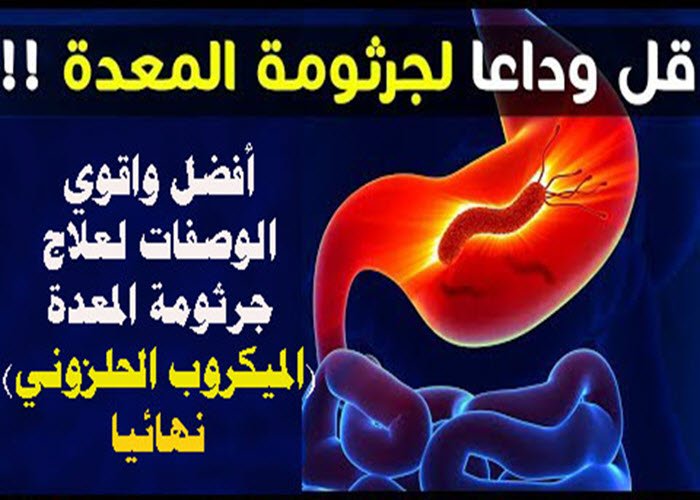 هل الثوم يقضي على جرثومة المعدة - علاج عظيم من الطبيعية لامراض المعدة 907 3